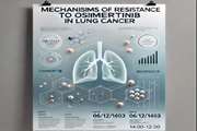 مکانیسم های مقاومت به Osimertinib  در سرطان ریه